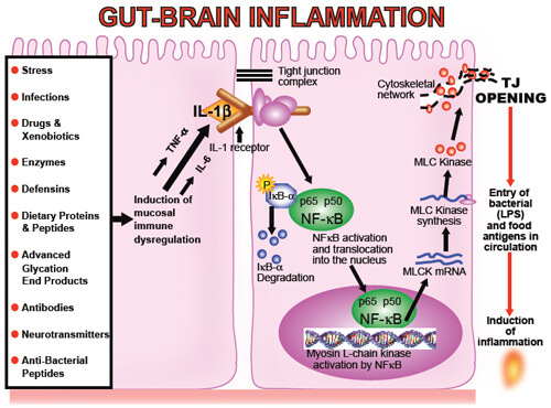 inflamaţie, intestin, creier